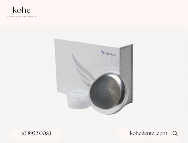 Angel Aligner Select vs Angel Aligner Pro • kohe™ Dental