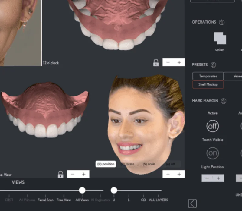 3D Facial Scanning For Personalised Treatment Planning - kohe Dental