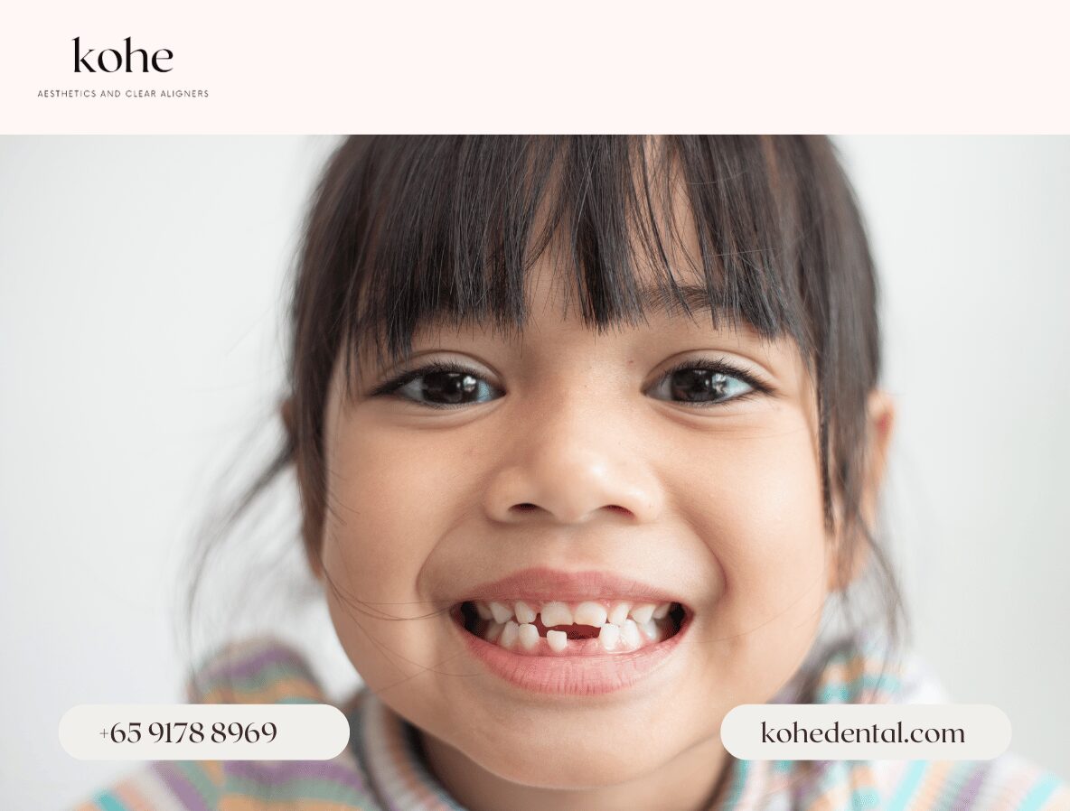 Child Smiling And Ready For Angel Aligner KiD - kohe Dental