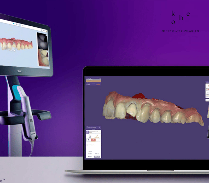 Clear Retainer Digital Database - kohe Dental