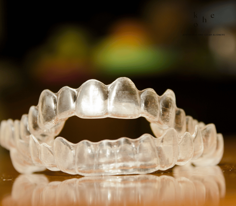 Clear Retainers Replacement - kohe Dental