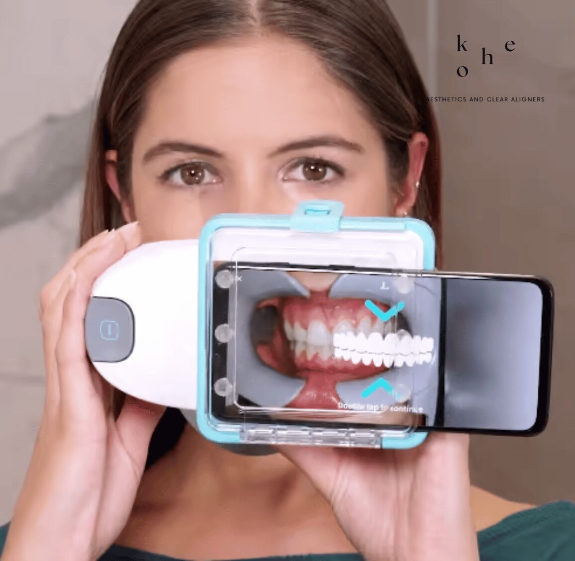 Remote Dental Monitoring - kohe Dental