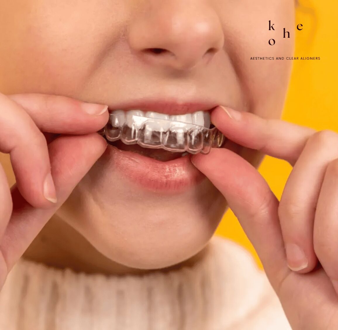 Girl Wearing Invisalign First - Invisalign First Easy and Fuss-Free Experience - kohe Dental