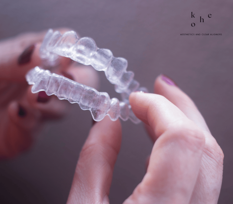 Lab-Made Clear Retainers - kohe Dental