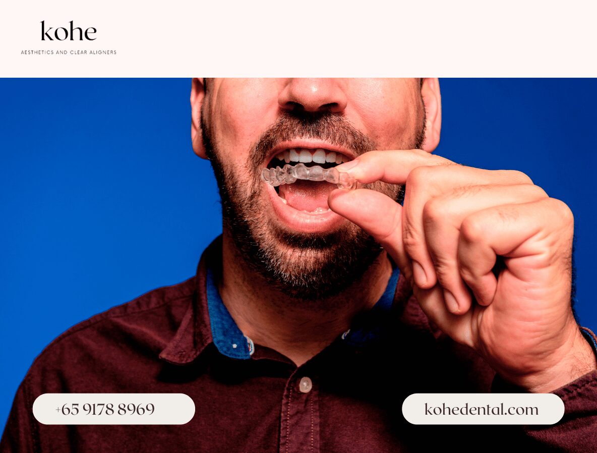 Man Wearing Clear Retainers - kohe Dental