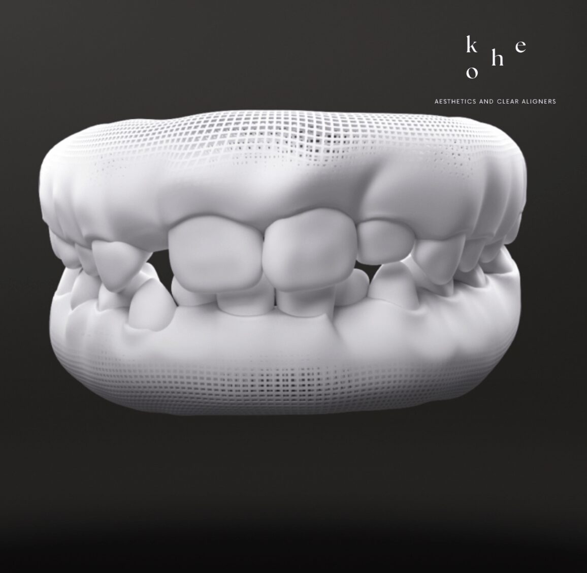 3D Invisalign First Model - Predictable Teeth Movement with Invisalign First - kohe Dental