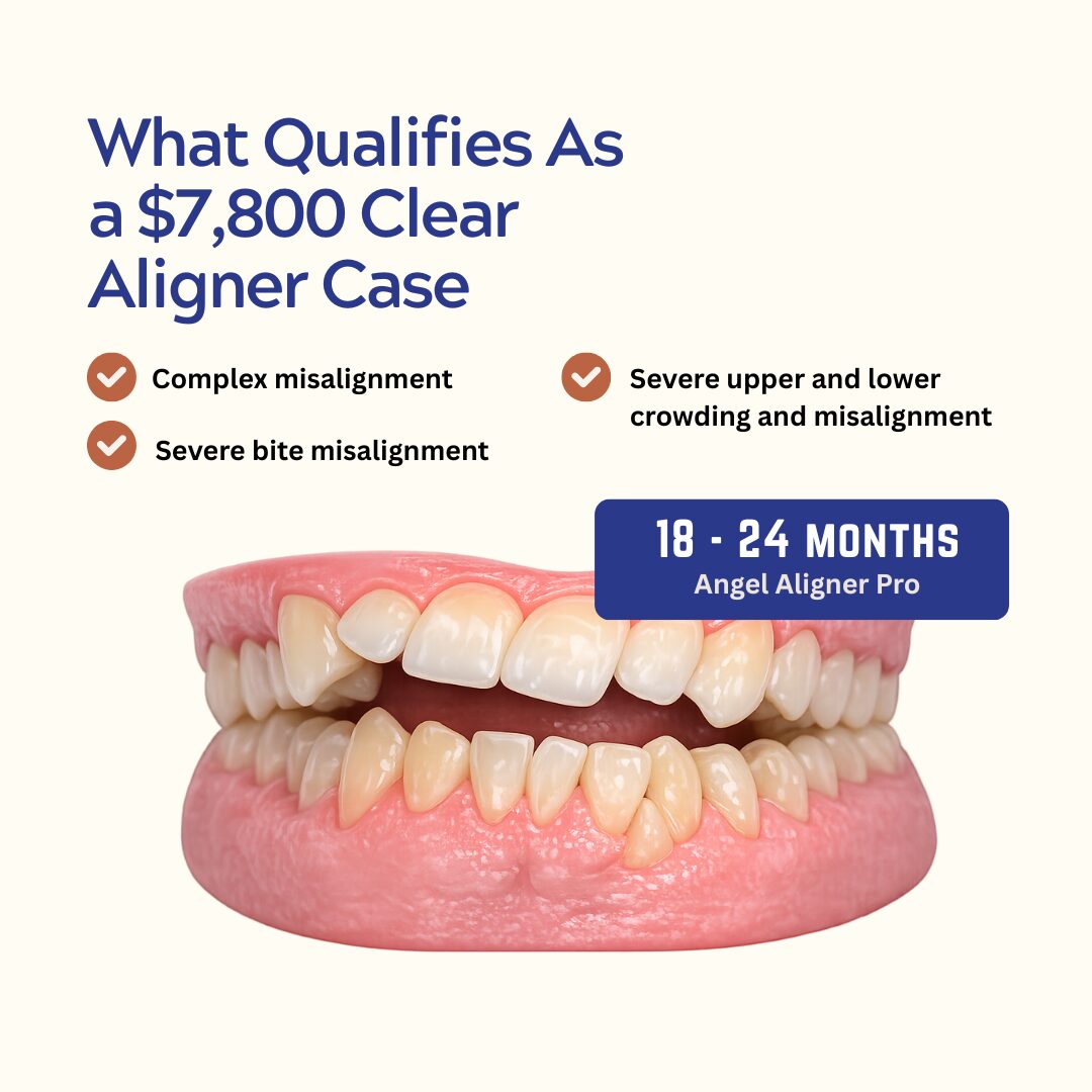 Angel Aligner Pro (2 Years Suitability - kohe™ Dental