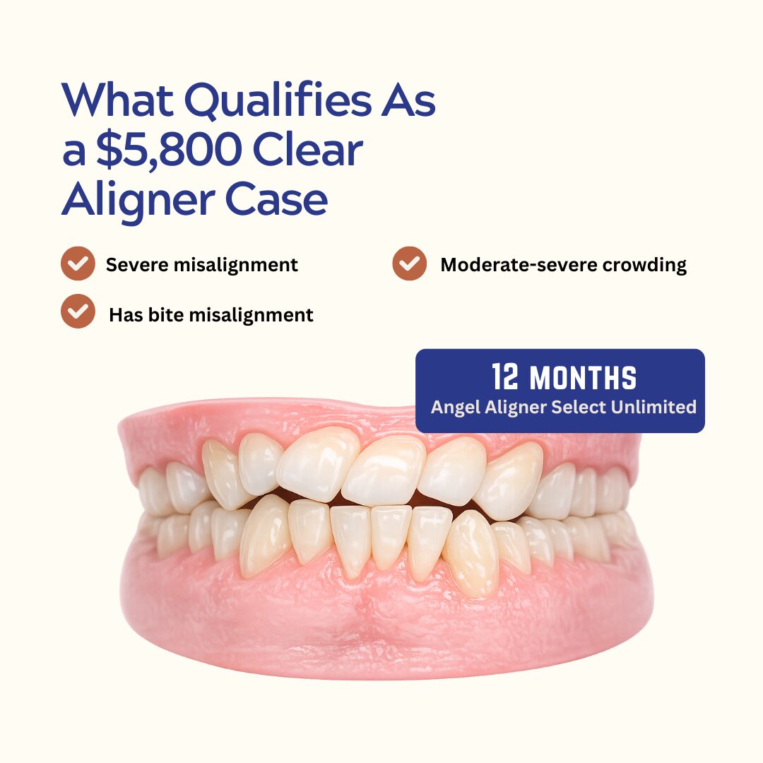 Angel Aligner Select Unlimited Suitability - kohe™ Dental