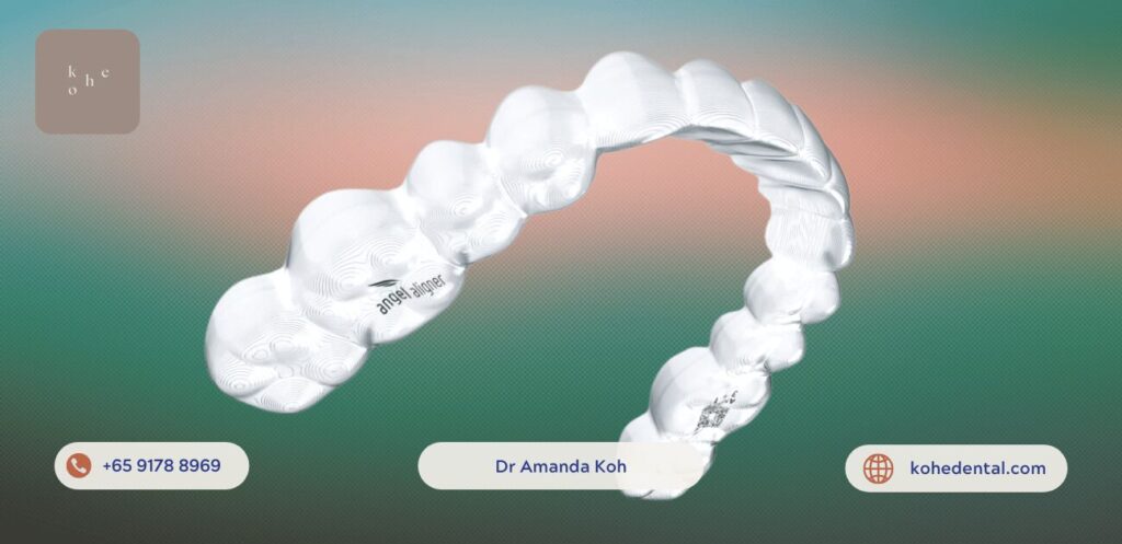 Affordable Angel Aligner (Invisalign Alternative) - kohe™ Dental