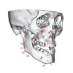 Treat Simple to Severe Jaw and Facial Assymmetry with kohe™ Dental - kohe™ Dental