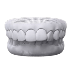 Treat Simple to Severe Overjet with kohe™ Dental - kohe™ Dental