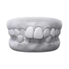 Treat Simple to Severe Overcrowding with kohe™ Dental - kohe™ Dental