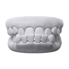 Treat Simple to Severe Underbite with kohe™ Dental - kohe™ Dental