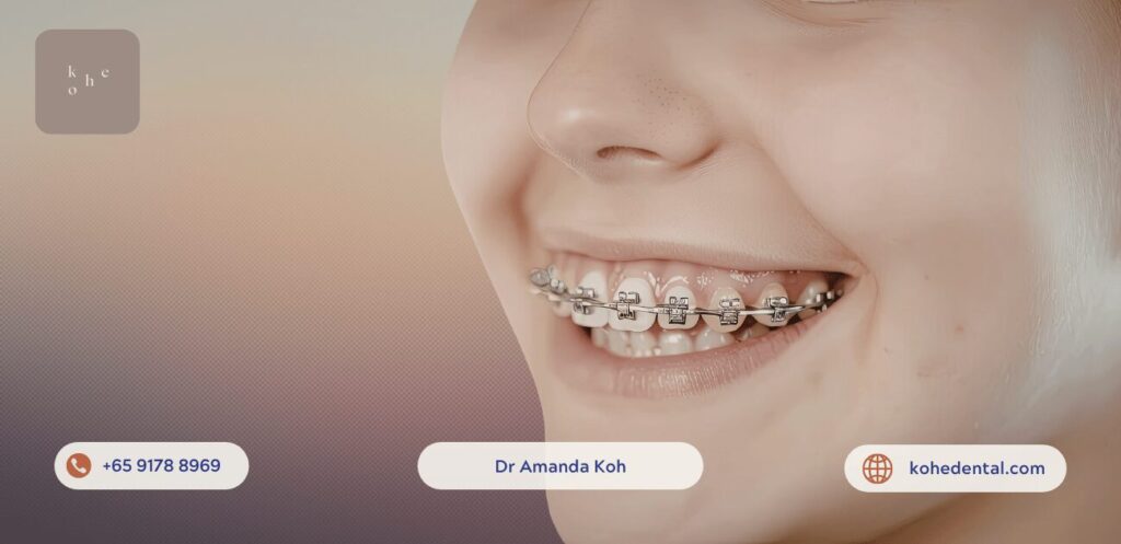 Young Child with Affordable Braces - kohe™ Dental