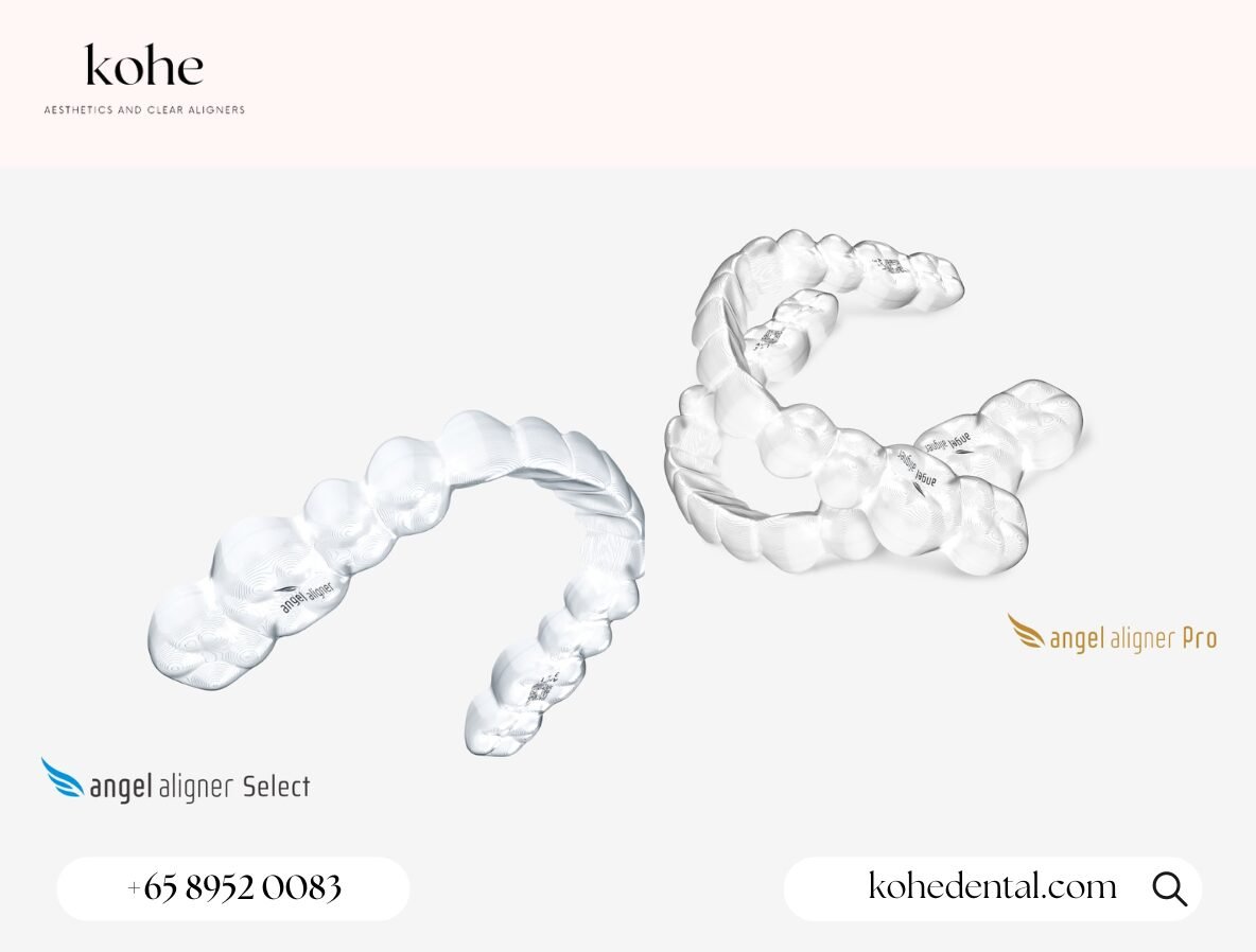 Angel Aligner Select vs Angel Aligner Pro 2 Angel Aligner Select vs Angel Aligner Pro - kohe Dental