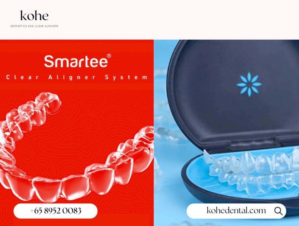 How Much Do Smartee Aligners Cost in Singapore? 2 Smartee Aligners vs Invisalign - kohe Dental