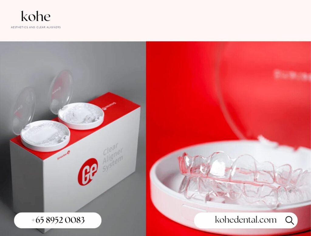 How Much Do Smartee Aligners Cost in Singapore? 1 Smartee Aligners Cost From $2,800 - kohe Dental