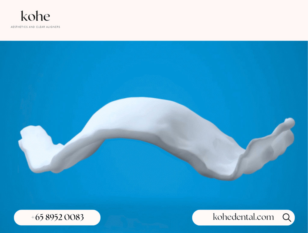 Invisalign Palatal Expanders (IPE): What Are They And How Do They Work? 1 Invisalign Palatal Expander (IPE) - kohe Dental