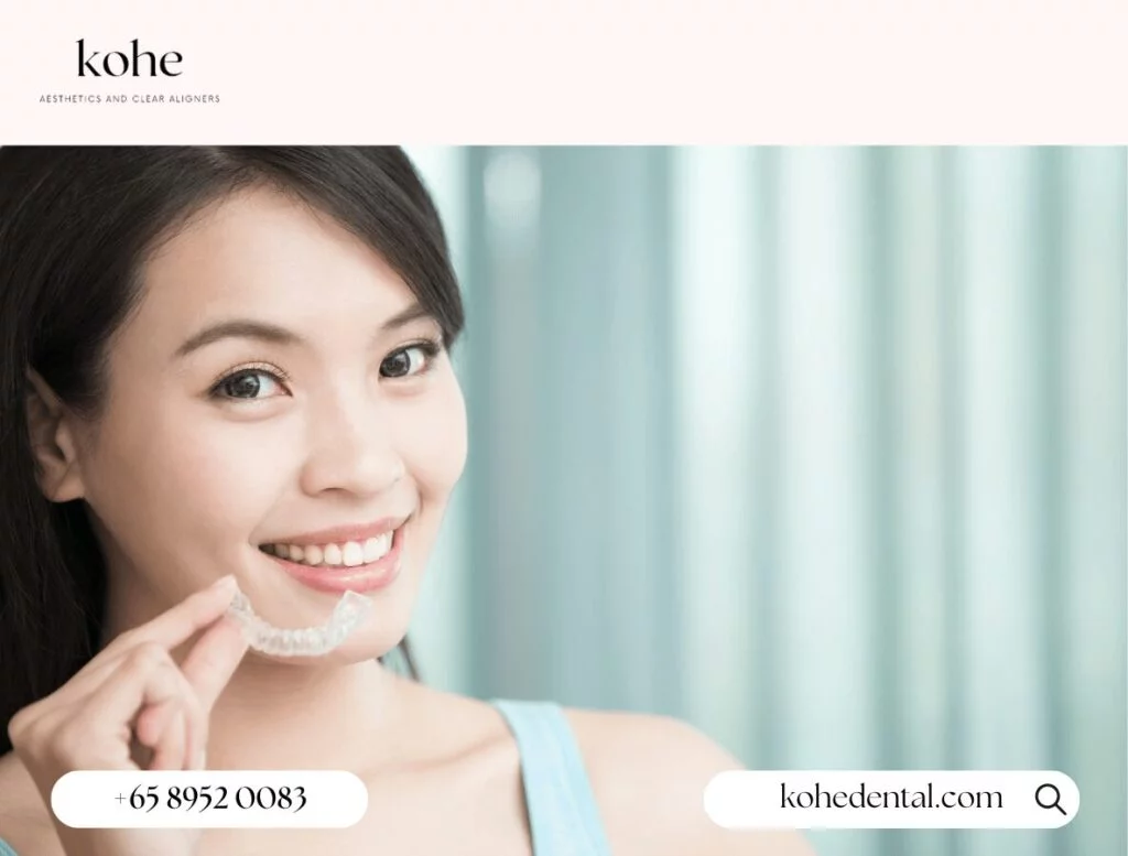 Invisible Braces (Clear Aligners) - kohe Dental