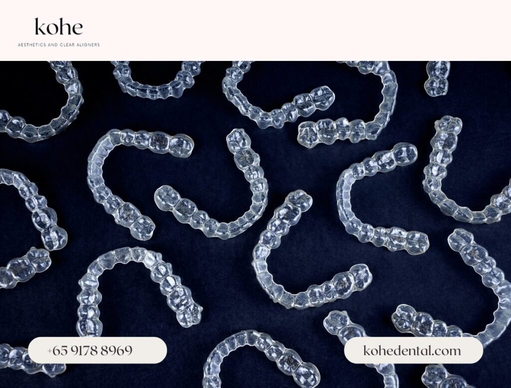 Why Are Clear Aligners So Expensive? 1 Why Are Clear Aligners So Expensive - kohe Dental