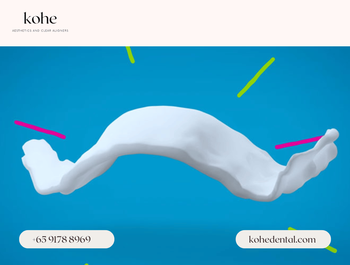 Invisalign Palatal Expander 2 Invisalign Palatal Expander (IPE) Orthodontic Device - kohe Dental
