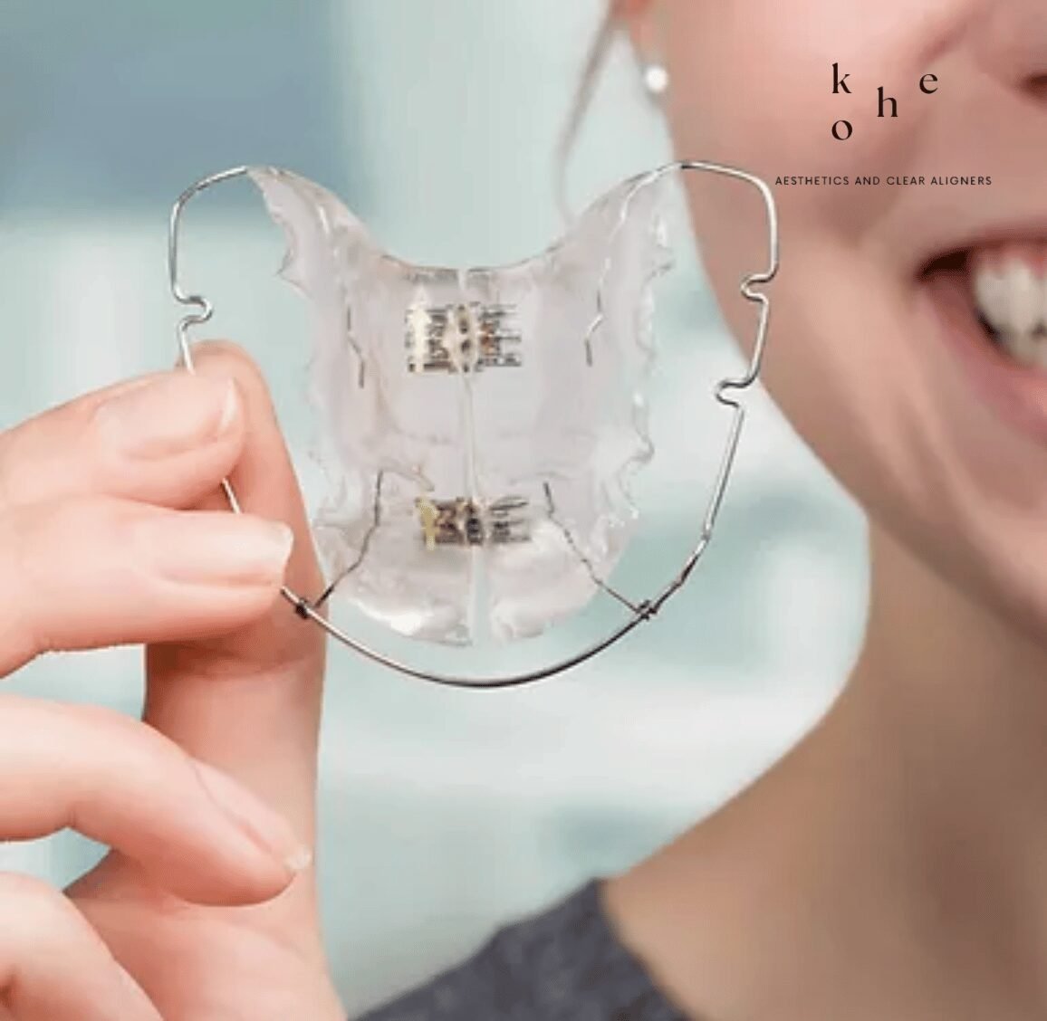Metal Retainers 9 Metal Retainers Allow For Natural Saliva Flow - kohe Dental