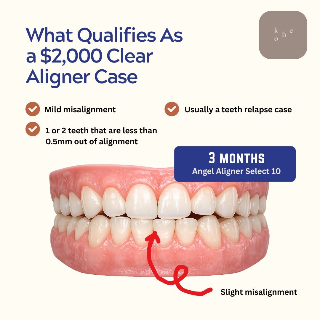 Angel Aligner Select 10 Suitability - kohe™ Dental