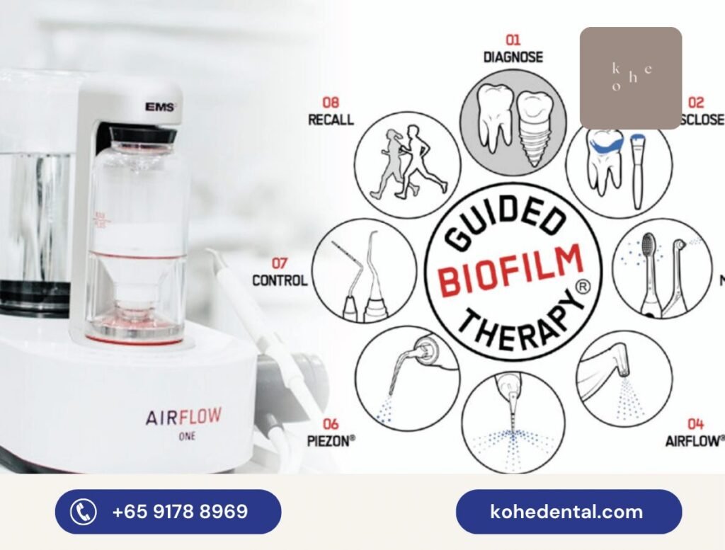 Guided Biofilm Therapy 1 Guided Biofilm Therapy Step by Step Approach - kohe™ Dental.png