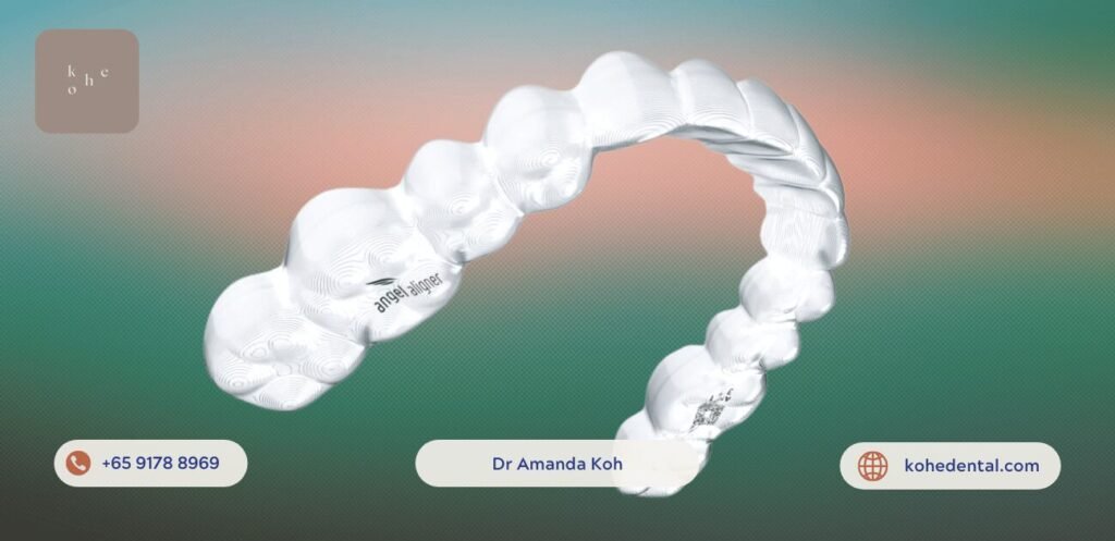 Affordable Braces Hack: Straighten Teeth on A Budget 9 Affordable Angel Aligner (Invisalign Alternative) - kohe™ Dental
