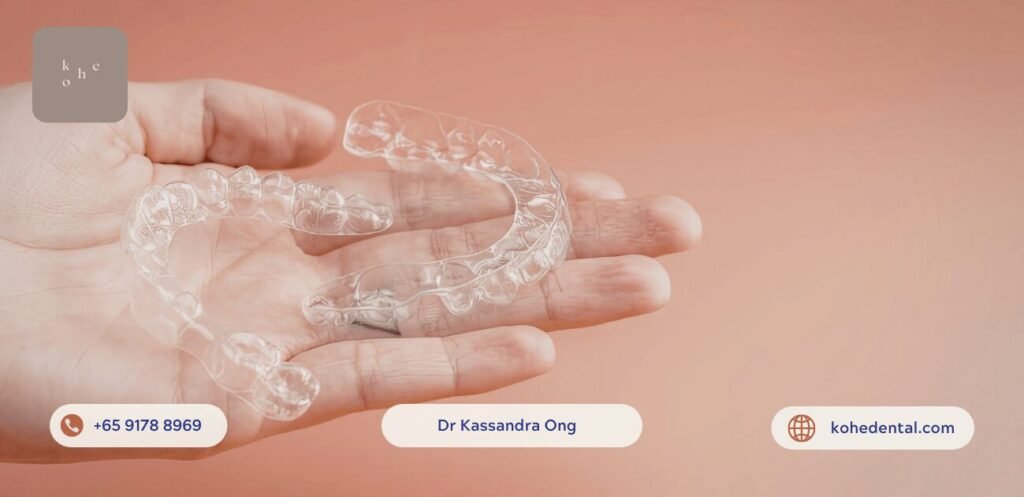 The Importance of A Realistic Budget for Clear Aligners 1 Clear Aligners - kohe™ Dental