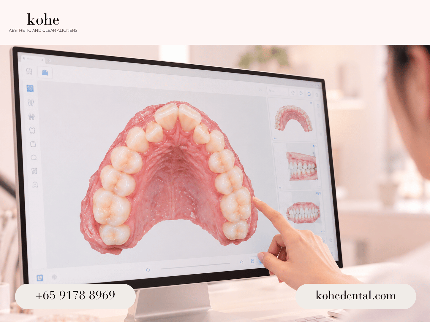 3d scans - kohe™ Dental