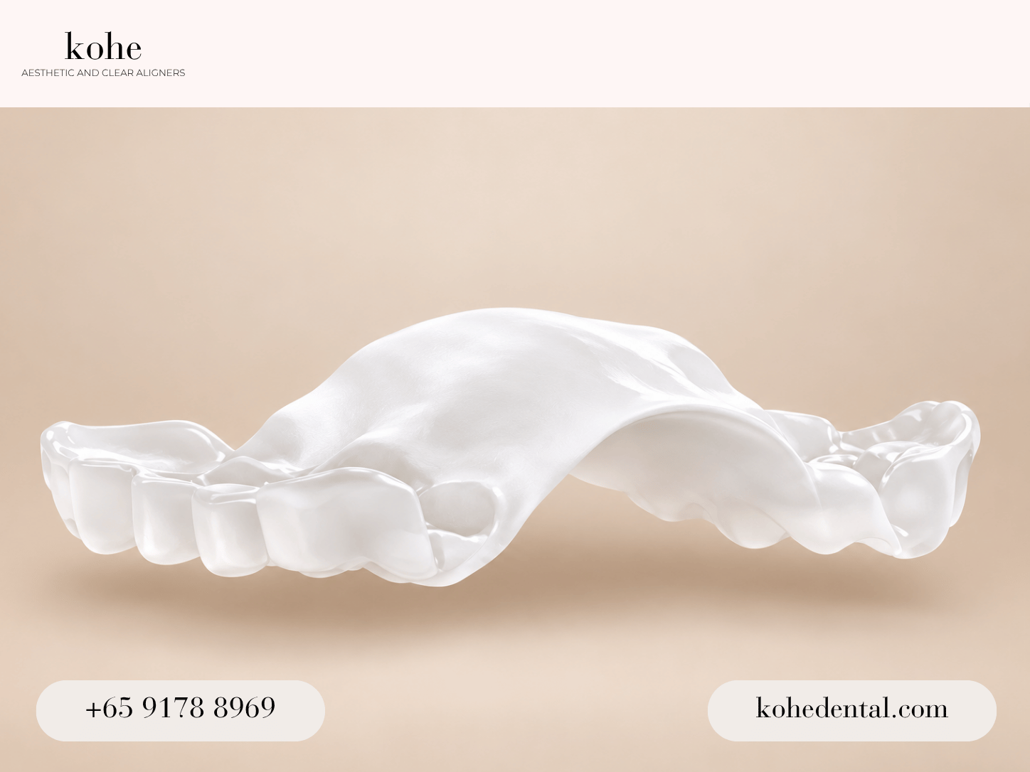 Invisalign palatal expander - kohe™ Dental
